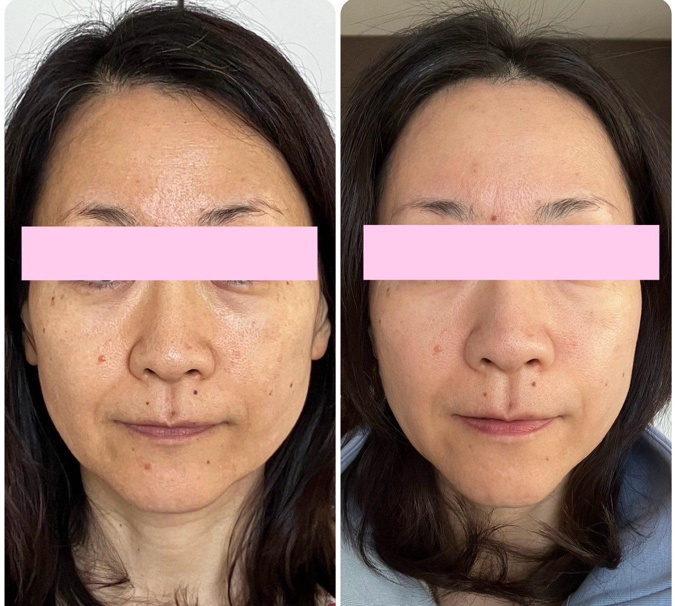 ビフォーアフター_240613_2